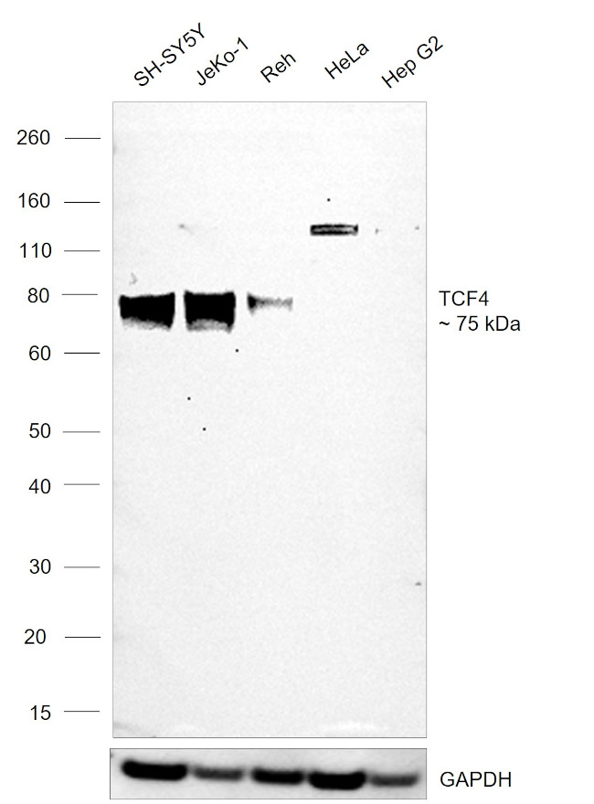 TCF4 Antibody in Western Blot (WB)