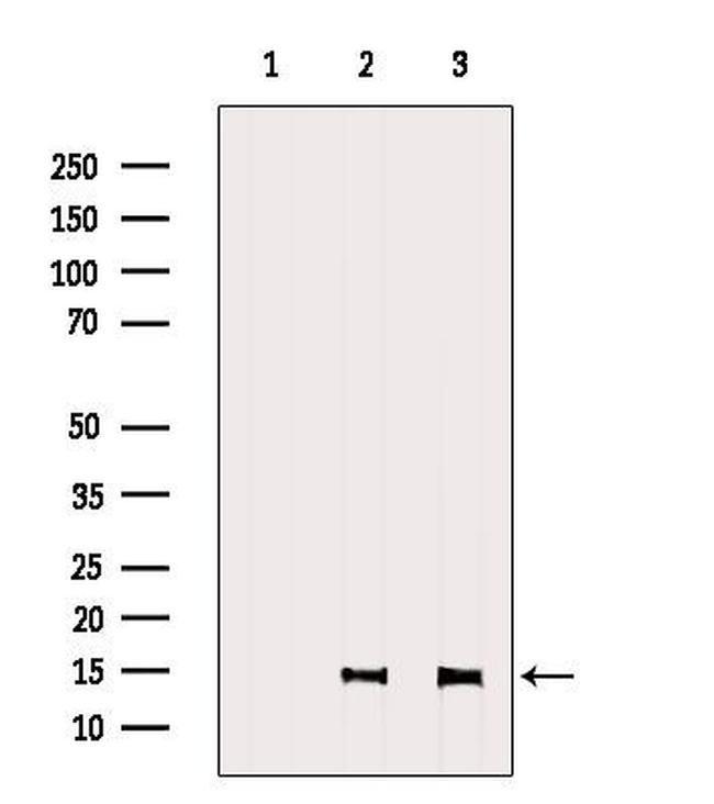 SH2D1A Antibody in Western Blot (WB)