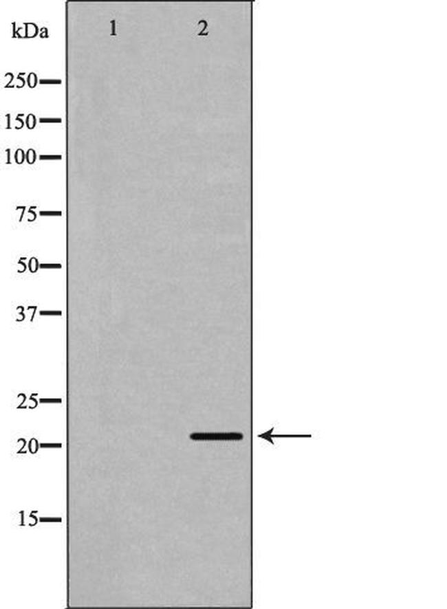 Bcl-W Antibody in Western Blot (WB)