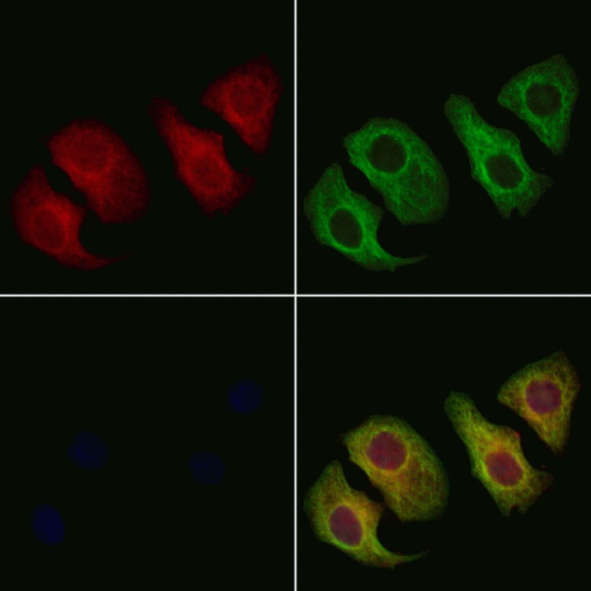 SMPD2 Antibody in Immunocytochemistry (ICC/IF)