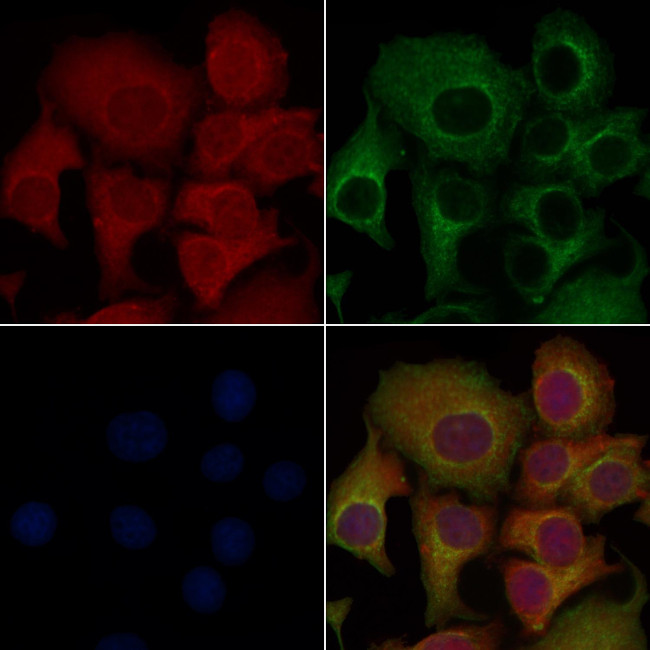 CD64 Antibody in Immunocytochemistry (ICC/IF)