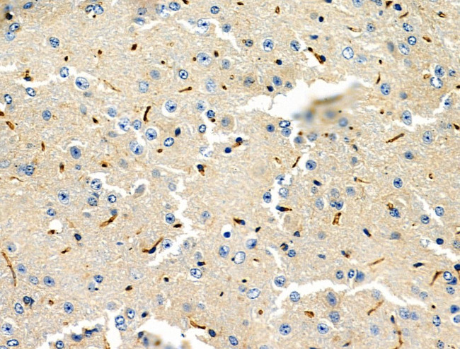 RASSF1 Antibody in Immunohistochemistry (Paraffin) (IHC (P))