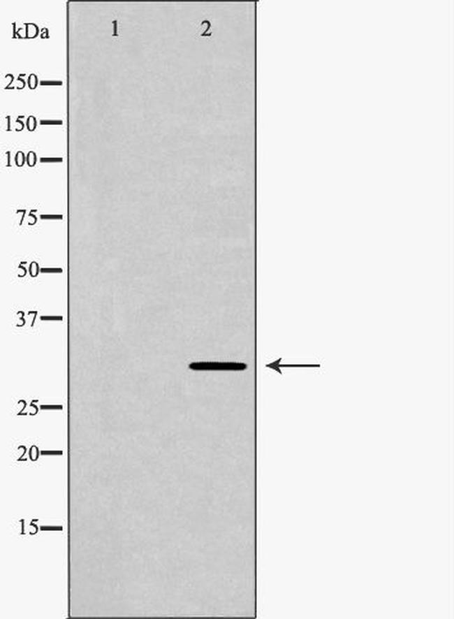 Carbonic Anhydrase III Antibody in Western Blot (WB)