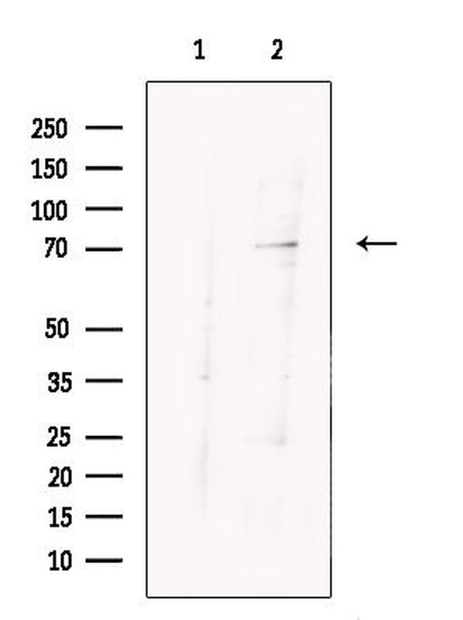 ARHGAP25 Antibody in Western Blot (WB)