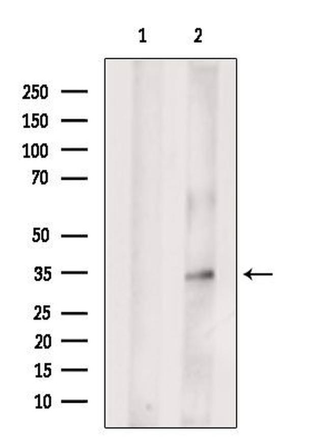 GIPC2 Antibody in Western Blot (WB)