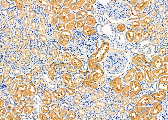 AKR7A2 Antibody in Immunohistochemistry (Paraffin) (IHC (P))