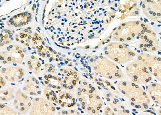 TAP2 Antibody in Immunohistochemistry (Paraffin) (IHC (P))