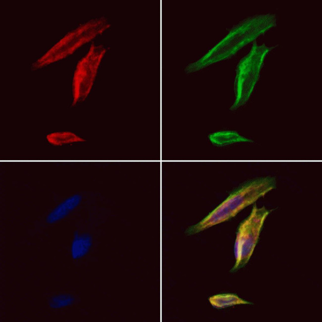HLA-DRB3 Antibody in Immunocytochemistry (ICC/IF)