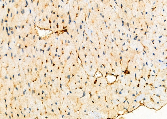 RFC1 Antibody in Immunohistochemistry (Paraffin) (IHC (P))