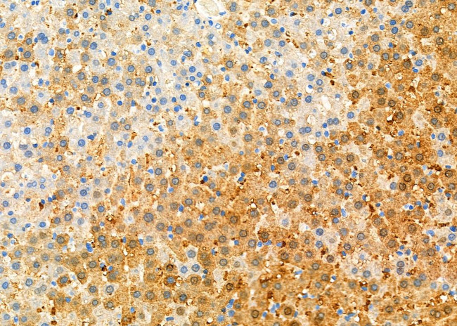 GSTA1 Antibody in Immunohistochemistry (Paraffin) (IHC (P))