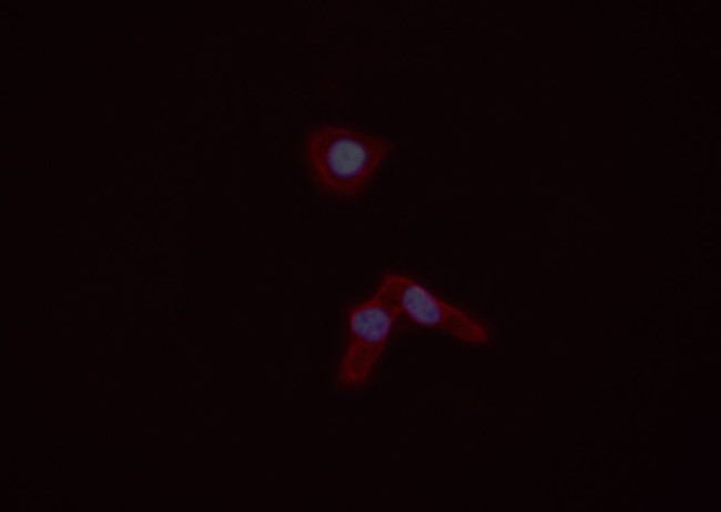 S100A4 Antibody in Immunocytochemistry (ICC/IF)