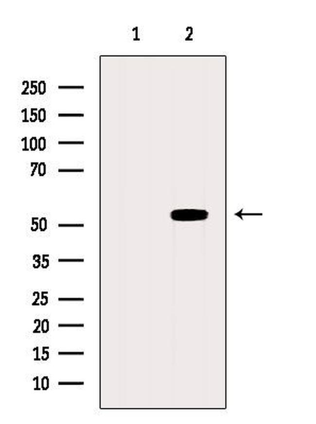 CHRNA5 Antibody in Western Blot (WB)
