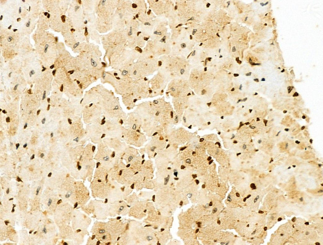 DNA ligase IV Antibody in Immunohistochemistry (Paraffin) (IHC (P))
