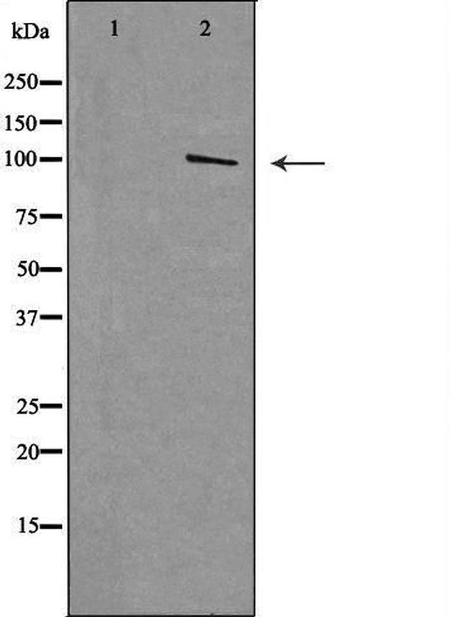 MTTP Antibody in Western Blot (WB)