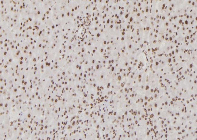 USF1 Antibody in Immunohistochemistry (Paraffin) (IHC (P))