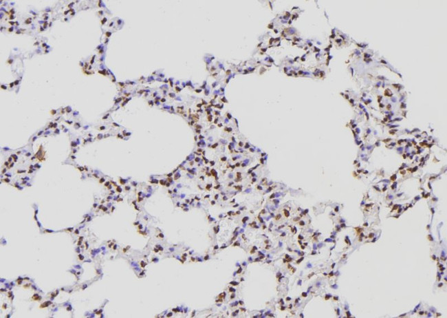 POLR2E Antibody in Immunohistochemistry (Paraffin) (IHC (P))