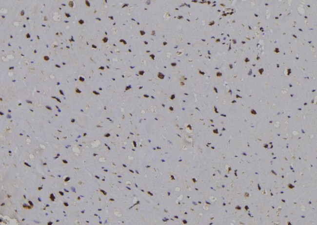 Cyclin D2 Antibody in Immunohistochemistry (Paraffin) (IHC (P))