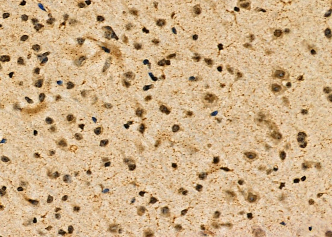 POLR2C Antibody in Immunohistochemistry (Paraffin) (IHC (P))