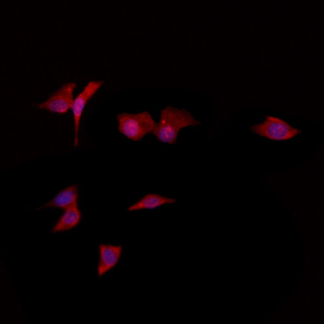 RGS2 Antibody in Immunocytochemistry (ICC/IF)