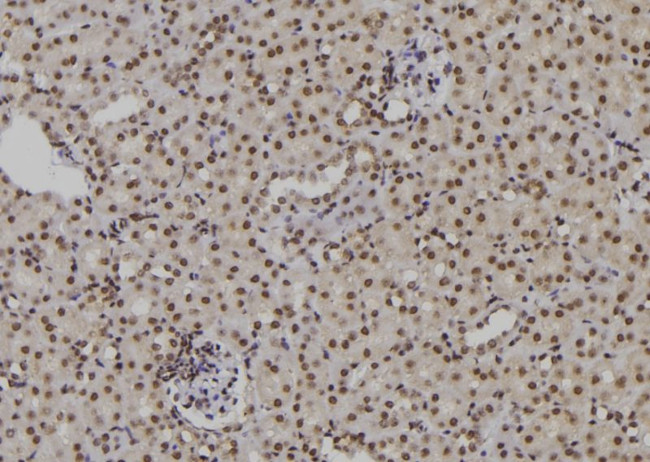 POLH Antibody in Immunohistochemistry (Paraffin) (IHC (P))