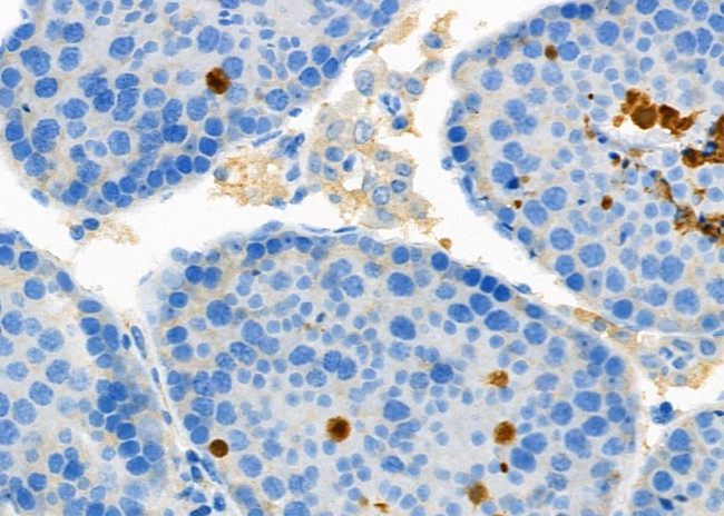 HCFC1 Antibody in Immunohistochemistry (Paraffin) (IHC (P))