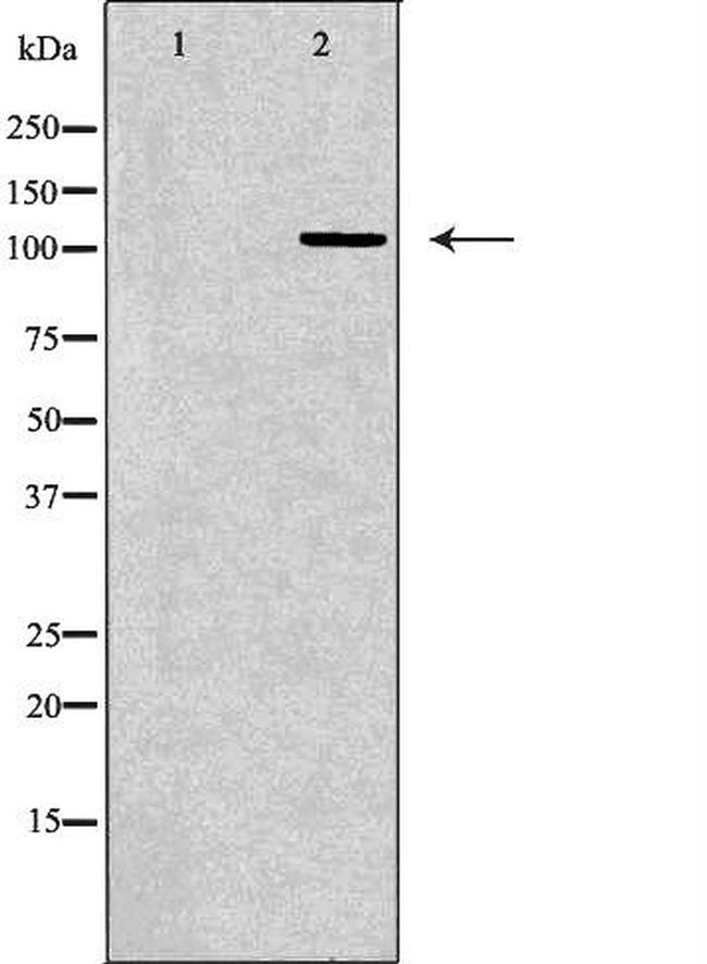 RPGR Antibody in Western Blot (WB)