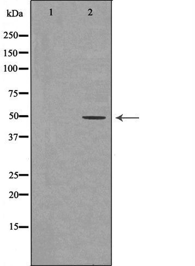 DDB2 Antibody in Western Blot (WB)
