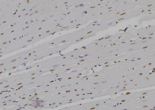 POLR2D Antibody in Immunohistochemistry (Paraffin) (IHC (P))