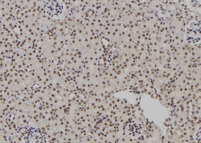 POLR2I Antibody in Immunohistochemistry (Paraffin) (IHC (P))