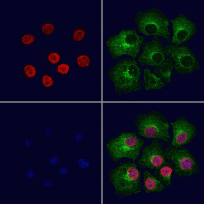 RUVBL2 Antibody in Immunocytochemistry (ICC/IF)
