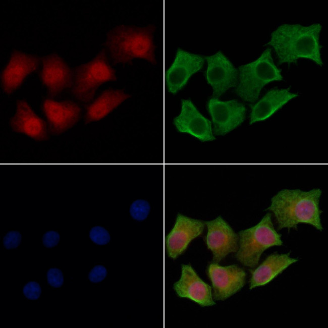HOXA9 Antibody in Immunocytochemistry (ICC/IF)