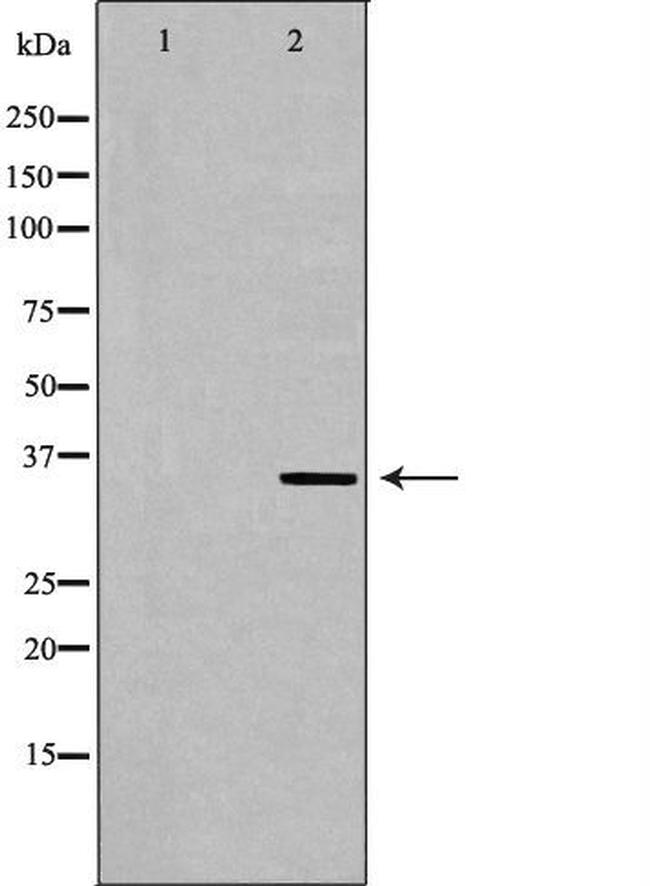 MNAT1 Antibody in Western Blot (WB)