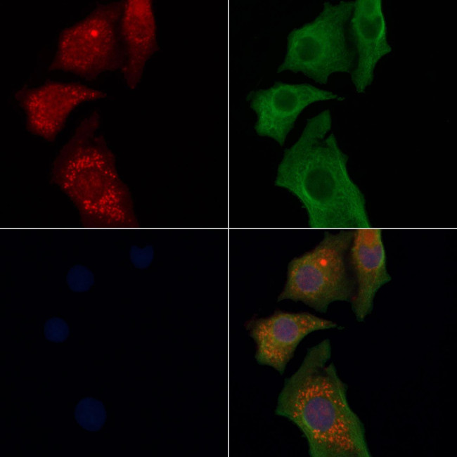Tapasin Antibody in Immunocytochemistry (ICC/IF)