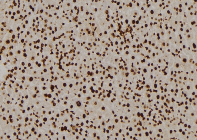 RPL5 Antibody in Immunohistochemistry (Paraffin) (IHC (P))