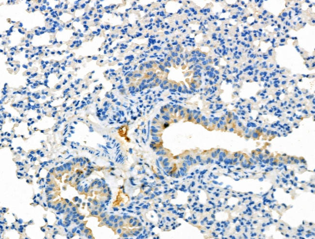 Thromboxane Synthase Antibody in Immunohistochemistry (Paraffin) (IHC (P))