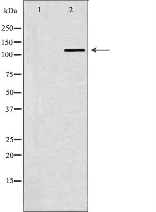 SMARCA5 Antibody in Western Blot (WB)