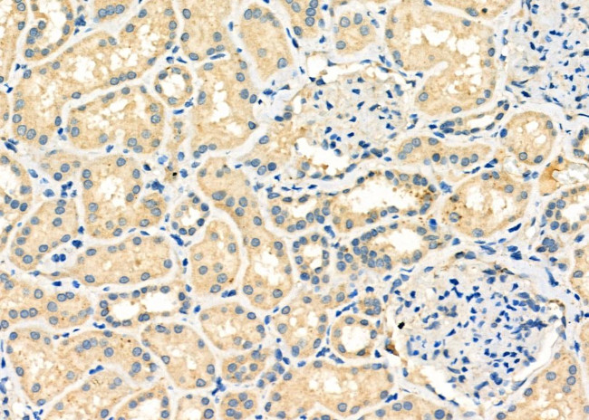 Cbl-b Antibody in Immunohistochemistry (Paraffin) (IHC (P))