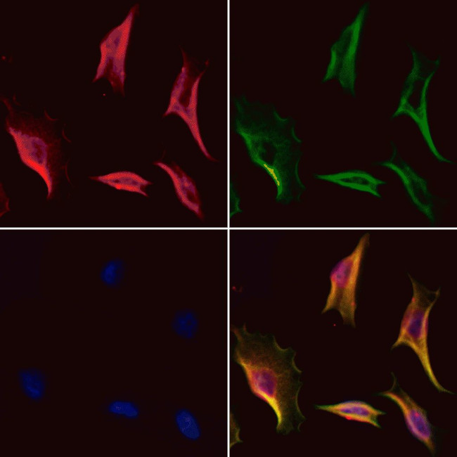 KPNA4 Antibody in Immunocytochemistry (ICC/IF)