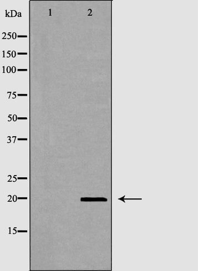CD69 Antibody in Western Blot (WB)