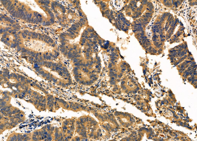 CAPZA2 Antibody in Immunohistochemistry (Paraffin) (IHC (P))