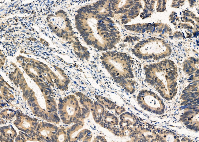 Torsin 1A Antibody in Immunohistochemistry (Paraffin) (IHC (P))