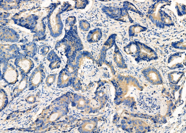 GNA15 Antibody in Immunohistochemistry (Paraffin) (IHC (P))