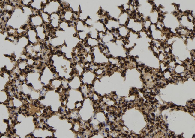 HCK Antibody in Immunohistochemistry (Paraffin) (IHC (P))