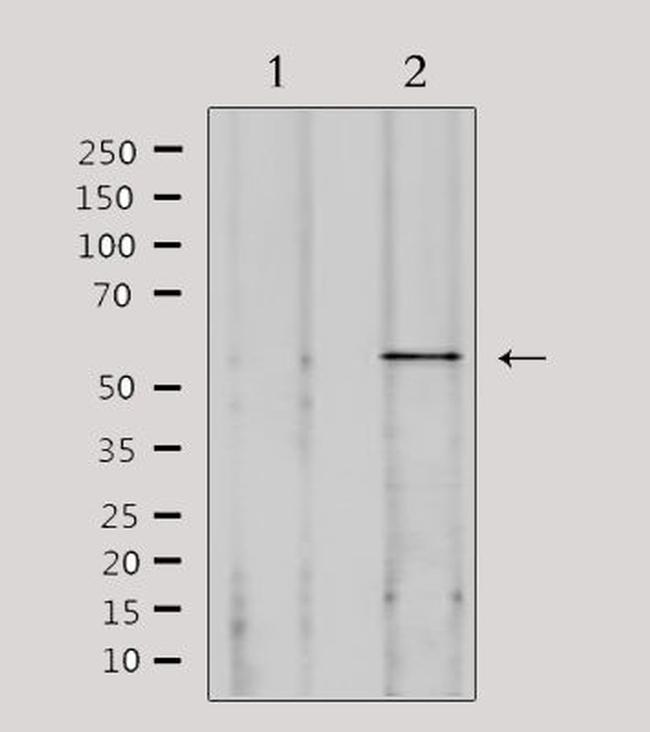 SPAM1 Antibody in Western Blot (WB)