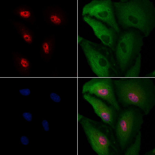 SPDYA Antibody in Immunocytochemistry (ICC/IF)