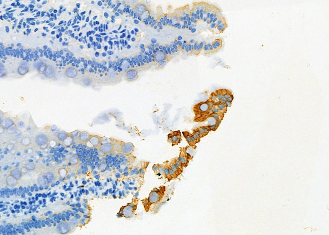 HLA-DQA1 Antibody in Immunohistochemistry (Paraffin) (IHC (P))