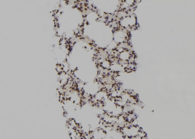 PSMA6 Antibody in Immunohistochemistry (Paraffin) (IHC (P))