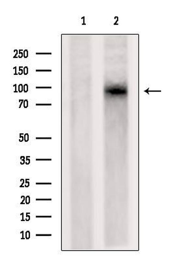 DLG7 Antibody in Western Blot (WB)