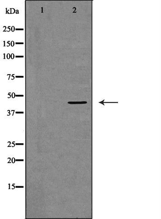 DCTN2 Antibody in Western Blot (WB)