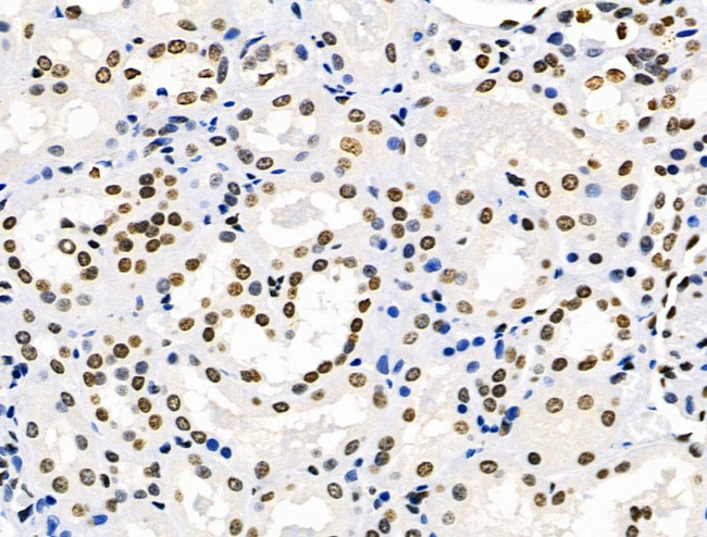 HEF1 Antibody in Immunohistochemistry (Paraffin) (IHC (P))